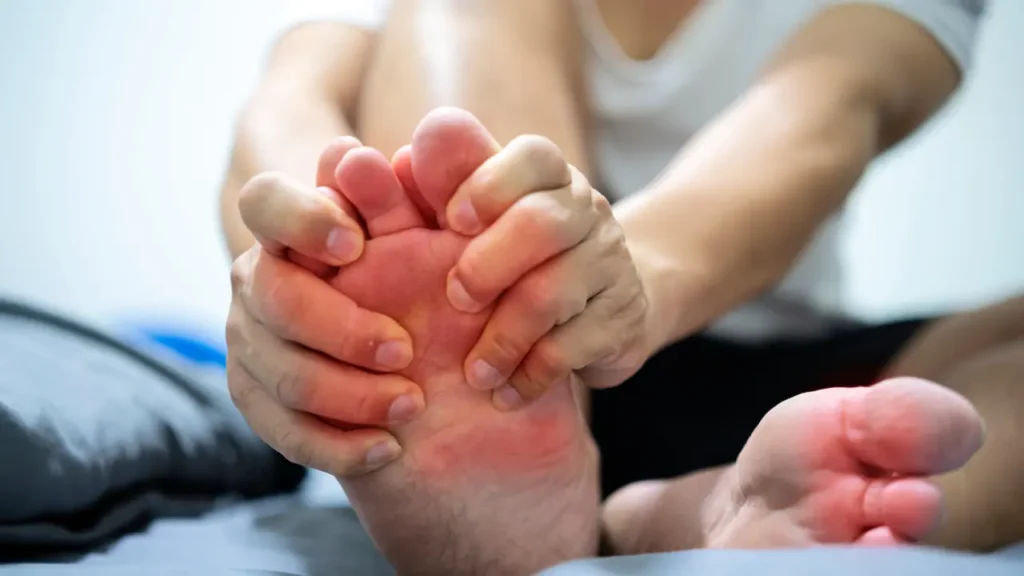 أعراض مرض النقرس