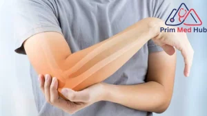 هل تختفي آثار لين العظام عند الأطفال؟