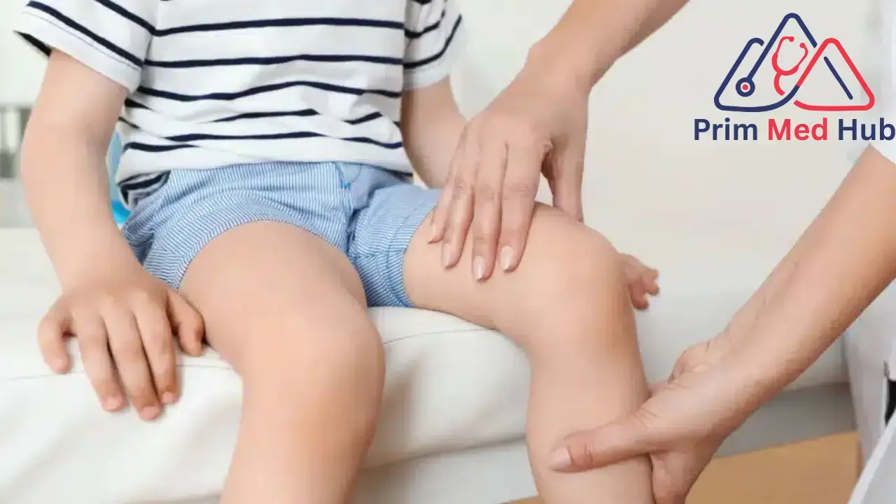 هل تختفي آثار لين العظام عند الأطفال؟