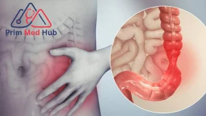 اكتشف أهم 10 أعراض القولون العصبي الشديدة - Prime Med Hub