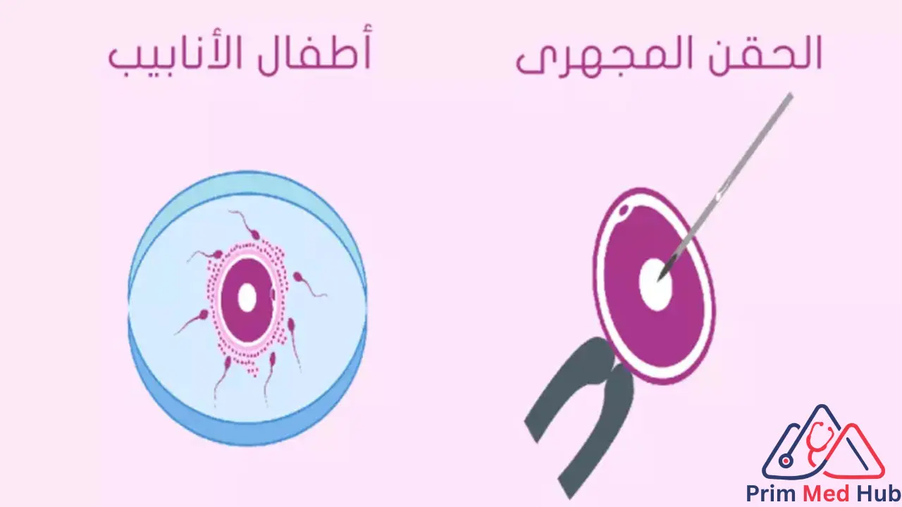 الفرق بين الحقن المجهري وأطفال الأنابيب