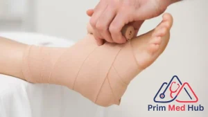 كم تستغرق مدة الشفاء بعد عمليات الكاحل؟ - Prim Med Hub