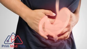 هل يمكن الشفاء وعلاج خزل المعدة بالمنظار؟ - Prim Med Hub